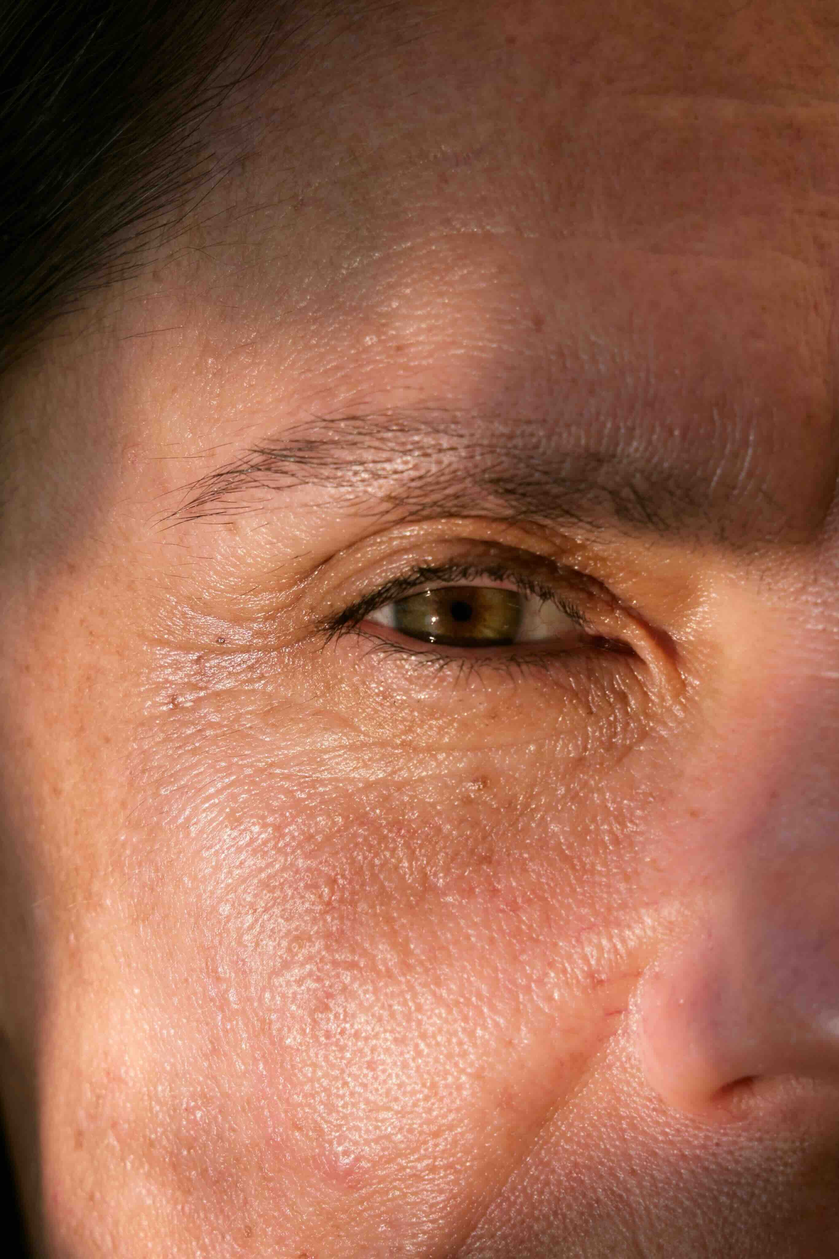 OJERAS